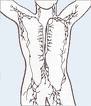 Lymphatic system