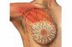 Mastopatia, nodes in the breasts