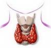 Thyroid disease