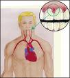 Periodontal disease, breach of tooth tissue